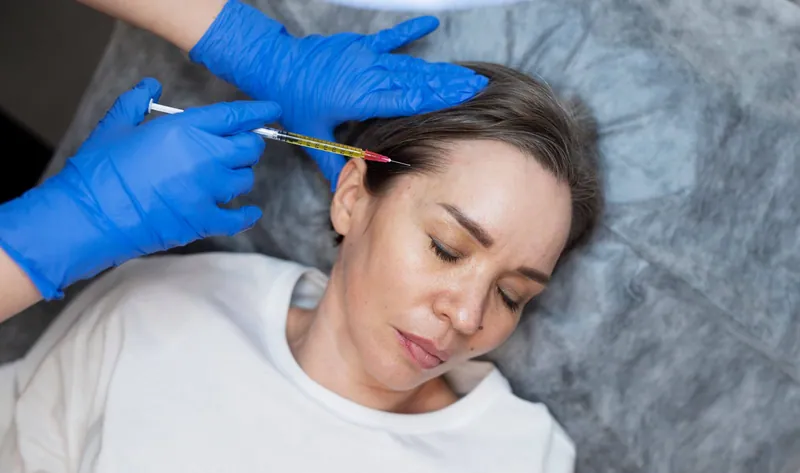 PRF skin treatment at Aesthetic Doctors Australia, Kew Melbourne: image 8