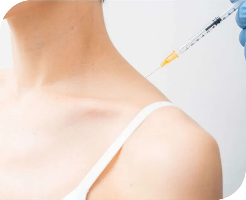 Trapezius slimming at Aesthetic Doctors Australia, Kew Melbourne: image 1