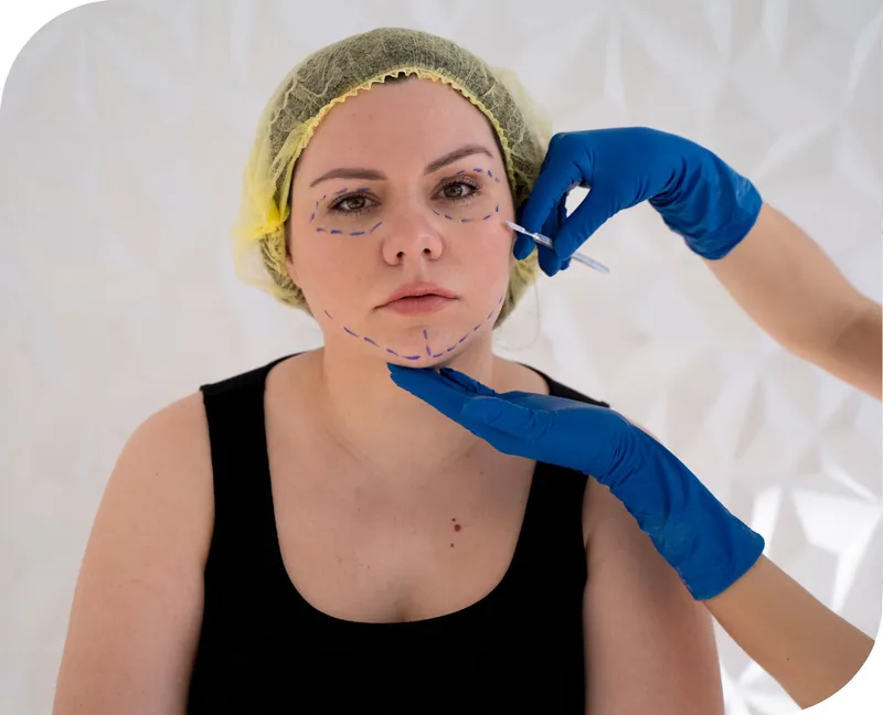 Teeth grinding & face slimming at Aesthetic Doctors Australia, Kew Melbourne: image 3