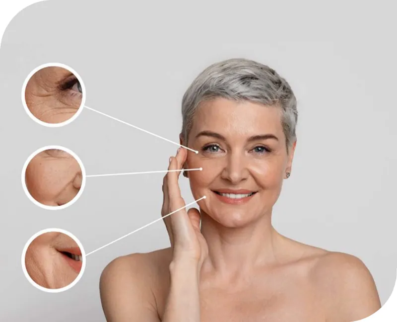Bioremodelling at Aesthetic Doctors Australia, Kew Melbourne: image 2