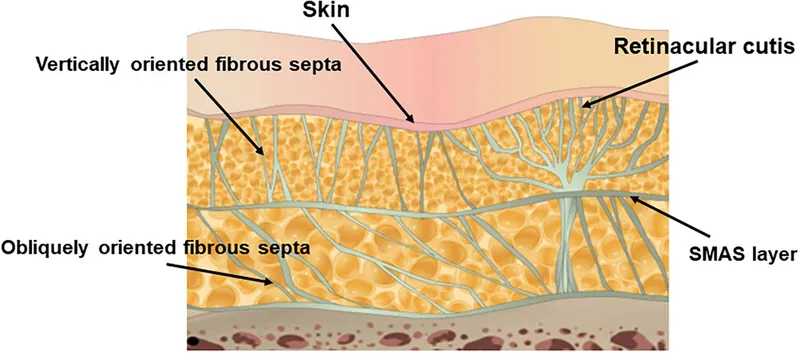 XERF skin tightening at Aesthetic Doctors Australia, Kew Melbourne: image 5