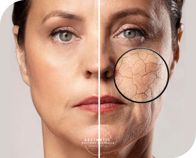 Bioremodelling at Aesthetic Doctors Australia, Kew Melbourne: image 1