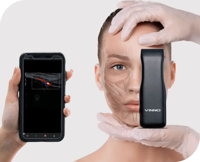 Dissolving & ultrasound at Aesthetic Doctors Australia, Kew Melbourne: image 1
